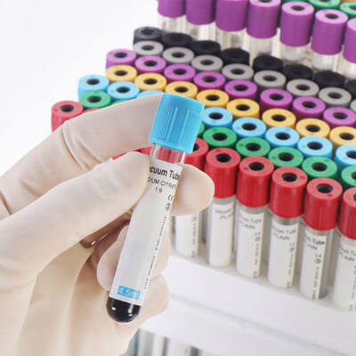comprare Tubi sanguigni EDTA a vuoto per la conta sanguigna completa (CBC) fabbricazione online