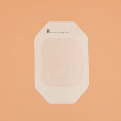 Buon prezzo Gesso arrotolato della fasciatura del film medico chirurgico trasparente sterile eliminabile dell'unità di elaborazione in linea