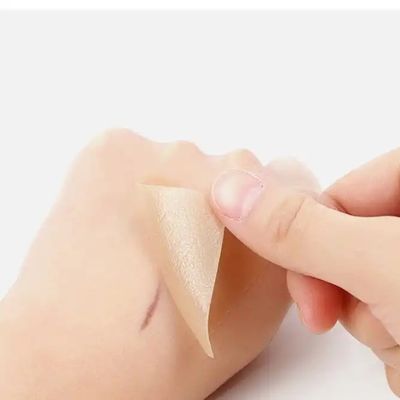 Buon prezzo Fogli cicatriziali in silicone, nastro, strisce - Cheloide curativo, cesareo, abdominoplastica - Trattamento delle cicatrici chirurgiche in linea
